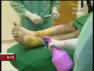 لقاء الدكتور احمد العيسى ضمن mbc في اسبوع 2_2