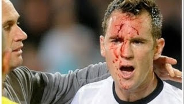 Un joueur s'essuie les crampons sur le visage d'un adversaire !