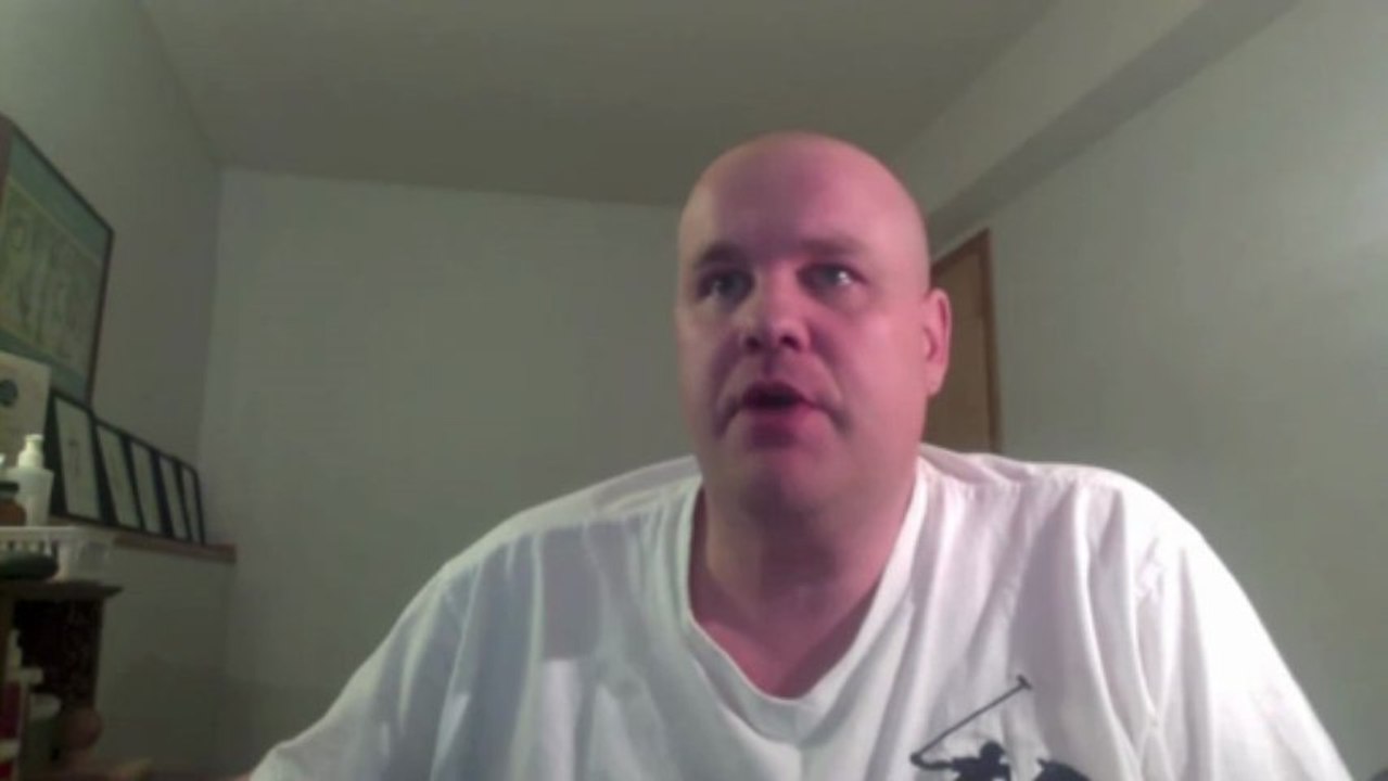 Knuckles and hand are swollen after giving massages