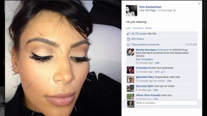 Kim Kardashian Punctured In Through Needles!