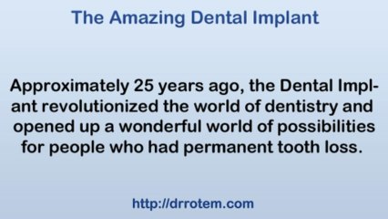 Dental Implants - The Convergence or Art and Science