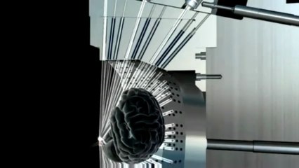 Cirugía sin Bisturí Leksell Gamma Knife