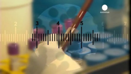 AIDS'in erken tedavisinde ilk adım