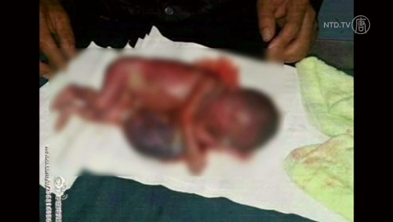 Forced Lethal Injection Ends 7-Month Pregnancy in China