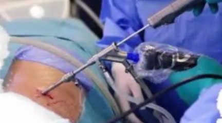 Colorado Spine Surgeons