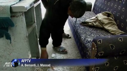 'Aleppo button' disease afflicts war-torn city