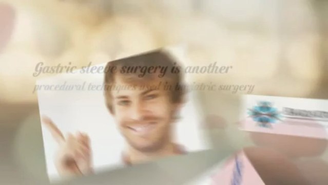 What is gastric sleeve surgery or sleeve gastrectomy