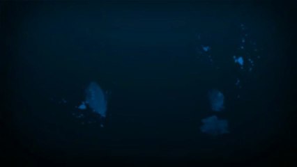 Dermal Fillers In Milton Keynes