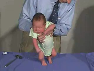 Primitive Reflexes - Stepping