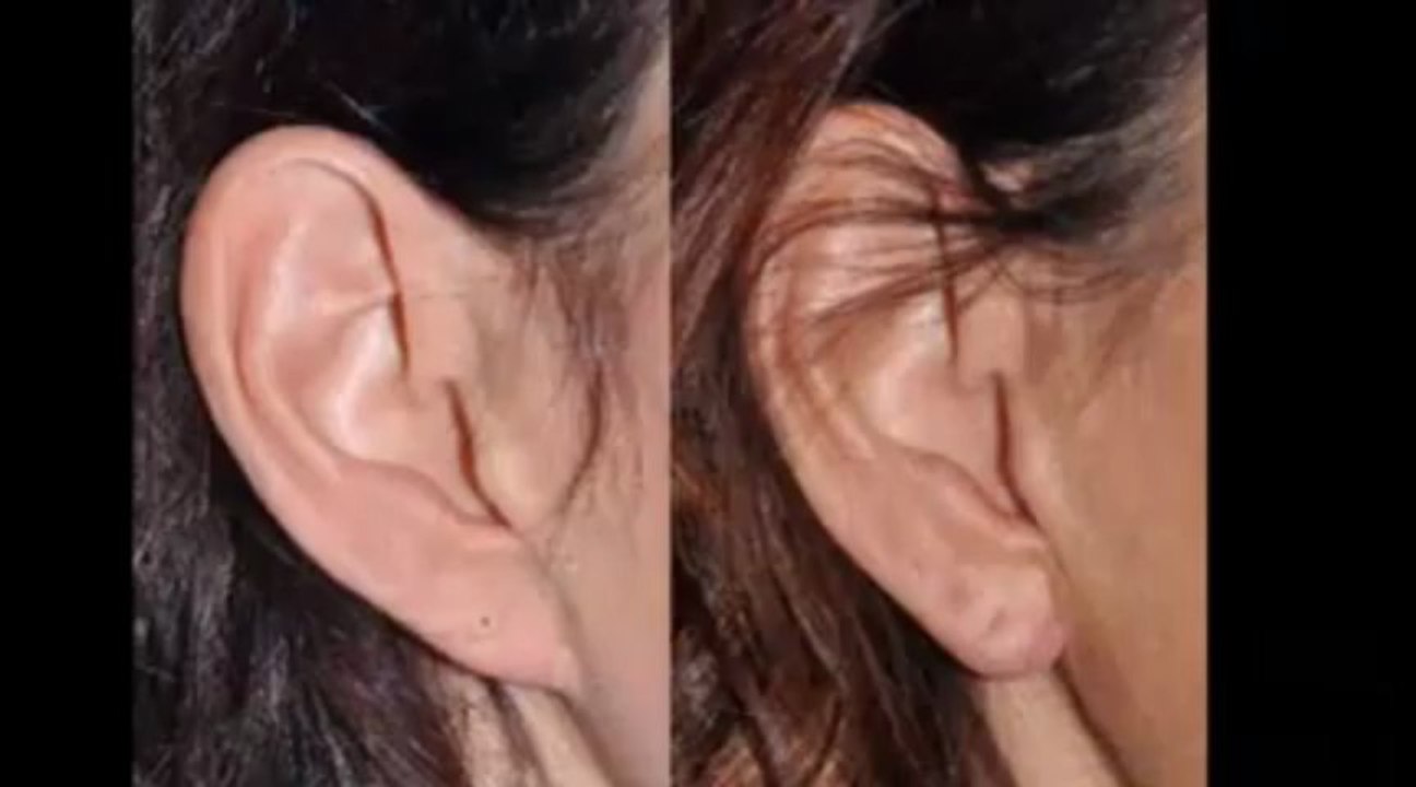 plastic surgeon Beverly hills