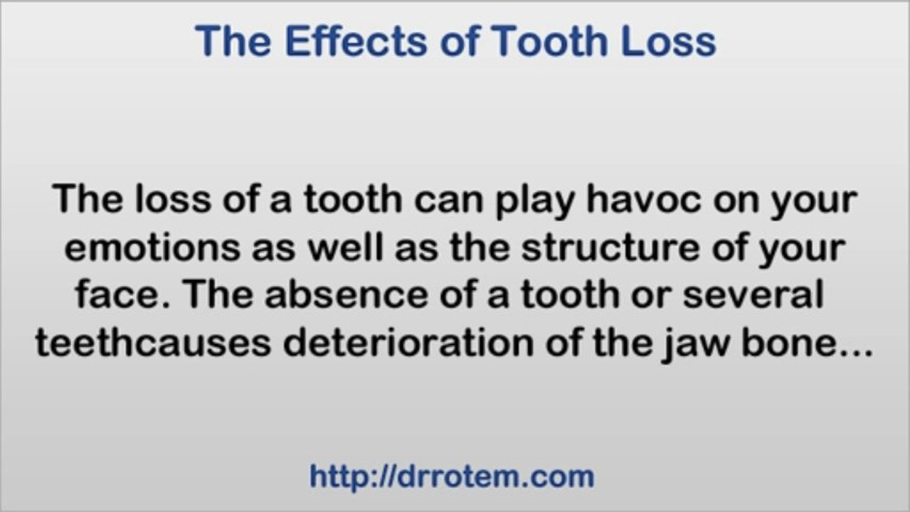 Can tooth loss Cause Structural Damage?