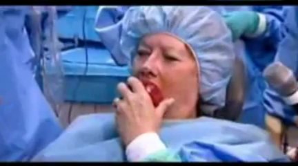 Patient Speaking about New Teeth One Day With ALL-ON-4 Dental Implant Procedure