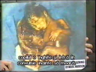 Avortul-imagini graitoare