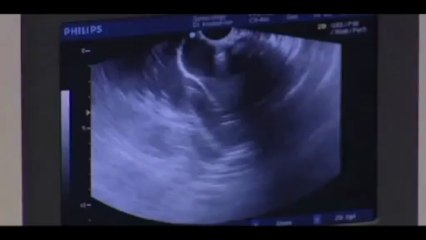 In Vitro Fertilization (IVF) Houston & Sugar Land