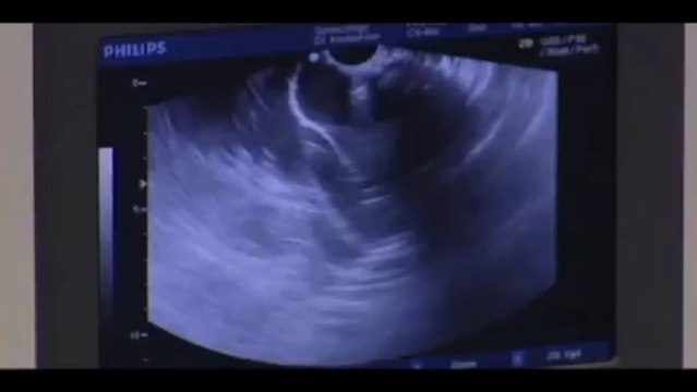 In Vitro Fertilization (IVF) Houston & Sugar Land