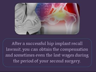 Stryker Hip Replacement Lawsuit