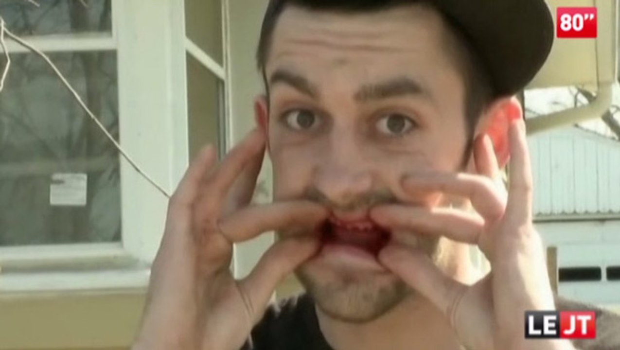 Dentiste Low-Cost qui arrache toutes les dents de son patient