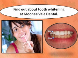 Find out about tooth whitening at Moonee Vale Dental.