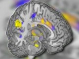 Doctors use brain scans to 'see' pain