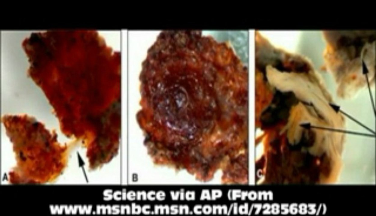 Major problem for evolution  T-Rex Blood Cells and Soft Tissue found_WMV V9