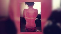 Bikini-Clad Kelly Osbourne Reveals Sunburn Marks