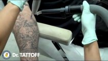 Comment effacer un tatouage en quelques secondes