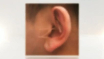 Denver Acupuncture - Dr. Mark Testa (303) 623-3215