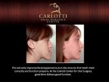 Jaw Surgery Scottsdale | Corrective Jaw Surgery - Carlotti