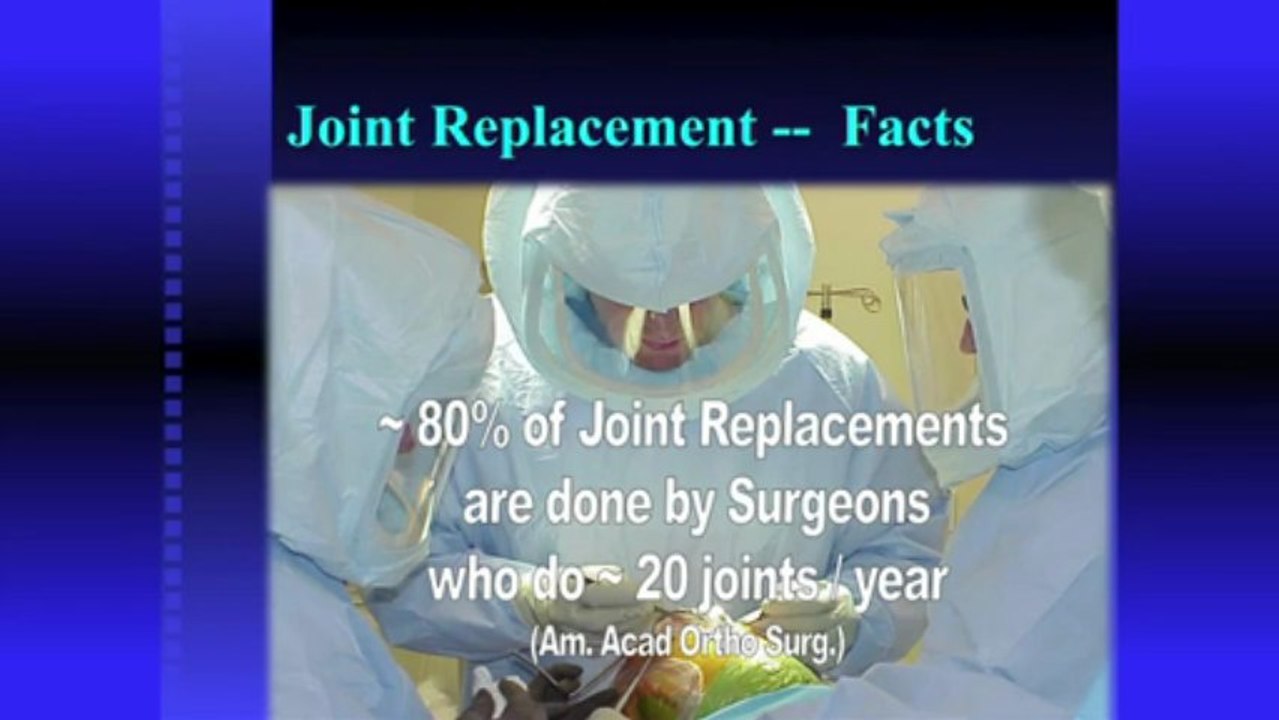 When to Consider Surgery for Arthritis.mov