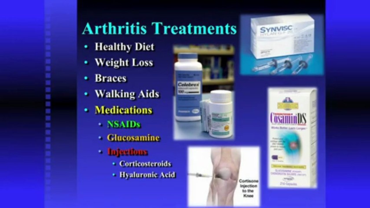 Arthritis Treatments.mov