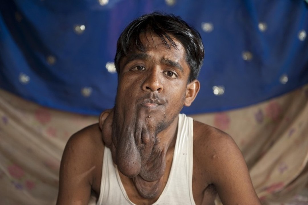 The Elephant Man
