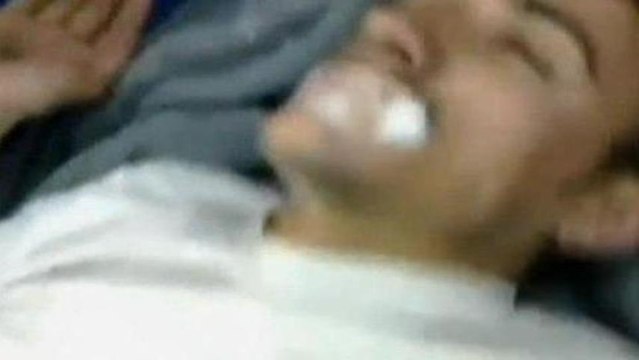 'Symptoms indicate chemicals use' in Syria