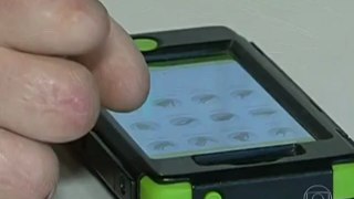 Mão biônica ultramoderna é controlada por aplicativo de celular