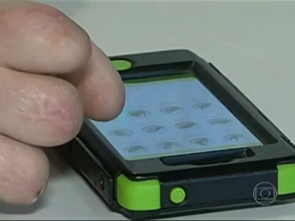 Mão biônica ultramoderna é controlada por aplicativo de celular