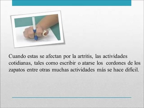 Como Curar la Artritis Reumatoide - CONSEJOS PROBADOS