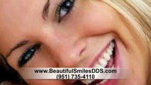 Dentist Norco CA | Gum Disease Norco CA