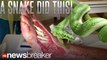 GROSS: Man VS Wild Host Posts Disgusting Video of Snake Bite Victim’s Wound; Pic Goes Viral