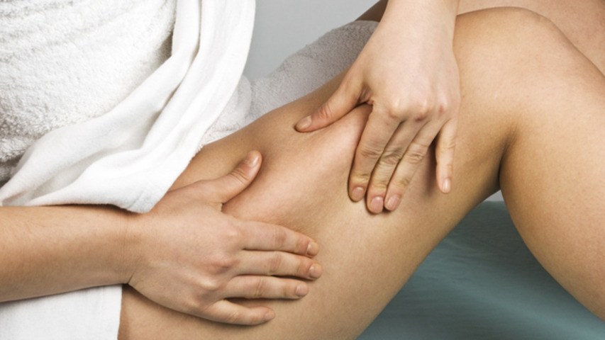 What causes cellulite?