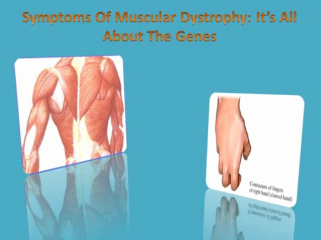 Muscular Dystrophy Symptoms