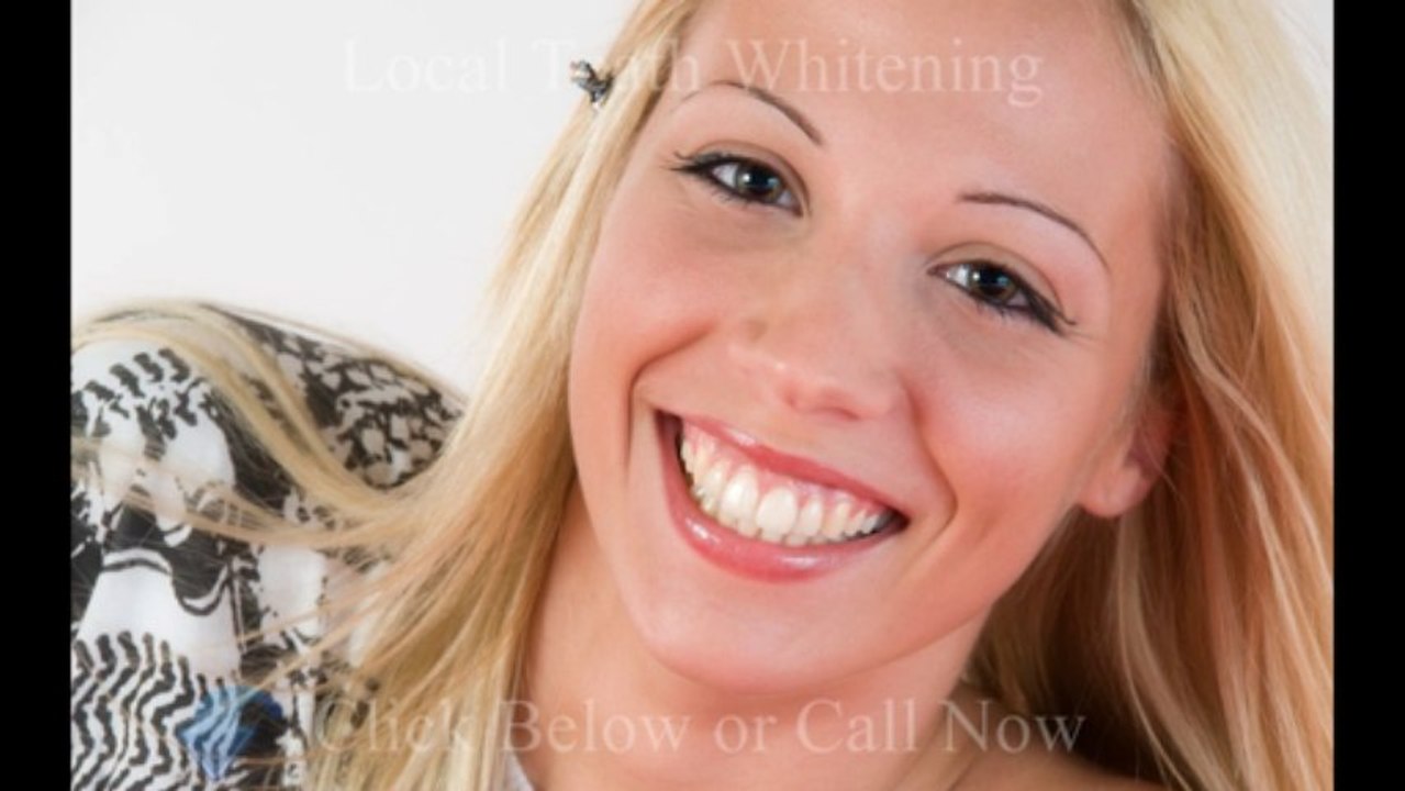 Teeth Whitening Dentist Toronto - For Great Service Call (877)399-9477