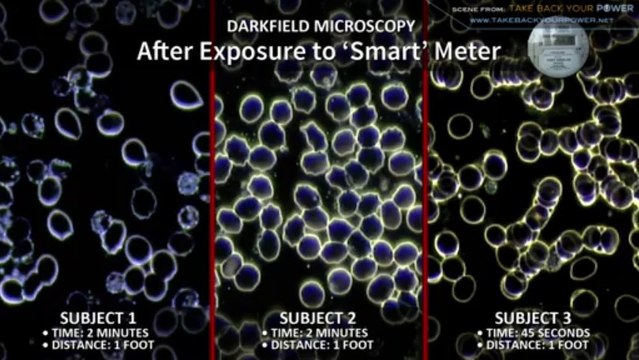 Take Back Your Power Smart Meters: Evidence Of Adverse Health Effects exclusive