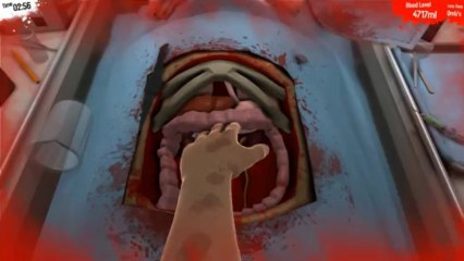 Jericho WINS Kidney Surgery! (Surgeon Simulator 2013)