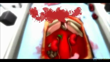 Soluce Surgeon Simulator 2013 : opération des reins