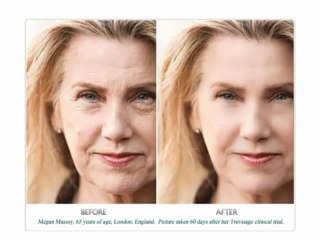 Best Anti Aging Serum