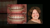 Sonoma Smiles Cosmetic Dentist Rohnert Park