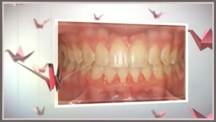 Orthodontist Dallas Apr2013