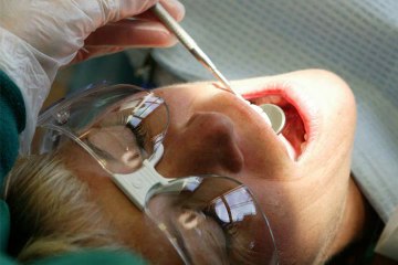 Dr Abid Faqir - Dental Patient Education - Wisdom Teeth