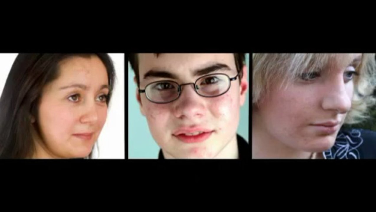 Acne No More Review - The Real Review About Acne No More Program