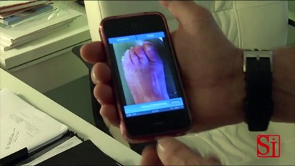 Napoli - Nuove tecniche per l'operazione dell'alluce valgo, int Catani (11.05.13)