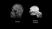 Brain-Machine Interface (BMI)